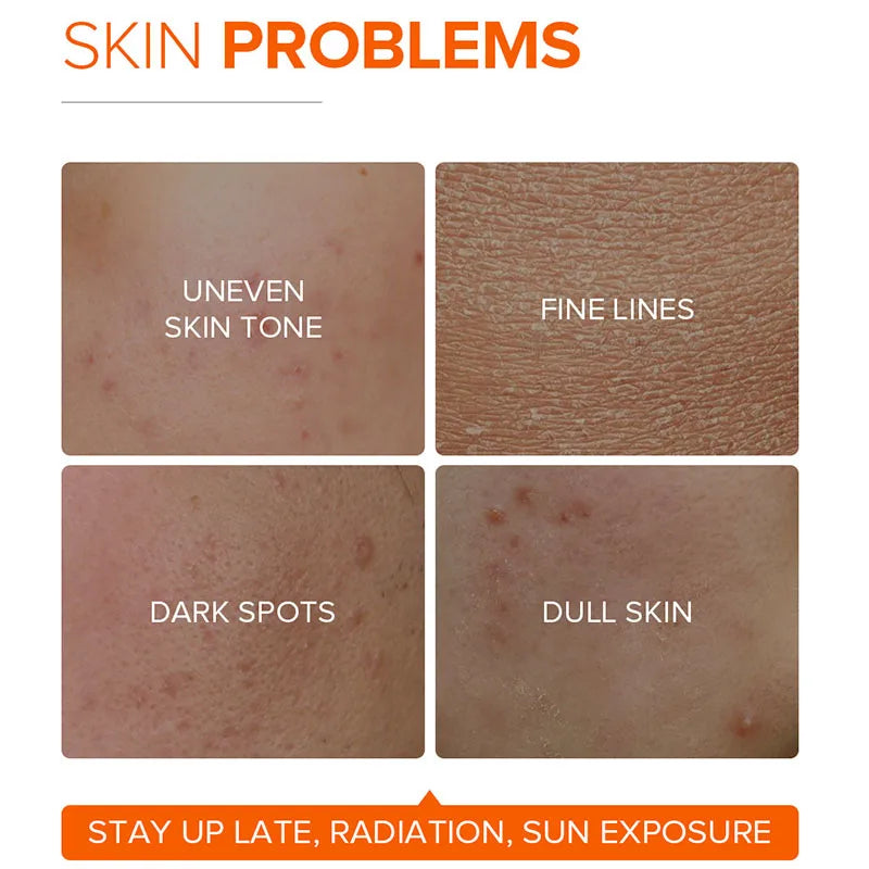 VC Five Fold Vitamin C Tone-Up Cream | Brightening Daily Moisturizer
